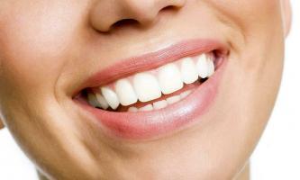 Máy làm trắng răng tại nhà hiệu quả nhất