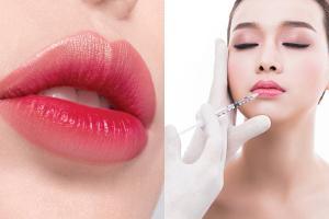 Địa chỉ tiêm filler - botox uy tín và chất lượng nhất tỉnh Bắc Giang