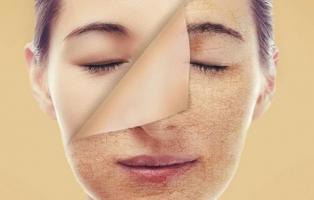 Bột tẩy tế bào chết hiệu quả nhất hiện nay
