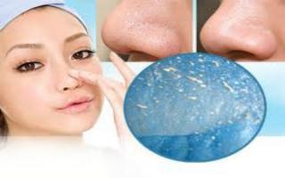 Cách trị mụn đầu đen bằng phương pháp tự nhiên hiệu quả nhất