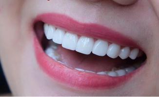 Địa chỉ bọc răng sứ uy tín nhất tỉnh Bình Thuận