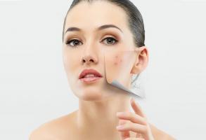 Địa chỉ lấy nhân mụn tốt và uy tín tại TP. HCM