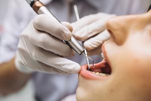 Địa chỉ nhổ răng khôn uy tín, an toàn nhất Tuyên Quang