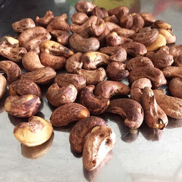 Hạt điều giúp ngăn chặn Sỏi mật