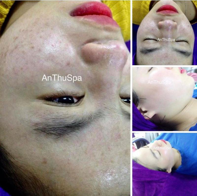 An Thu Spa