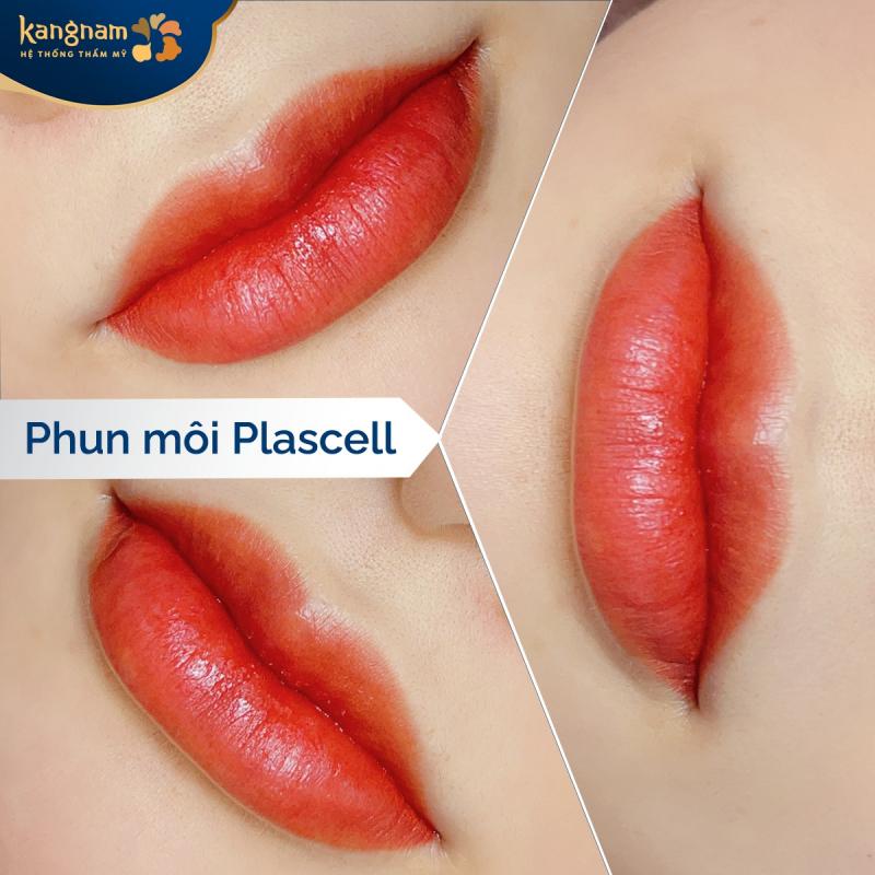 Bệnh viện thẩm mỹ Kangnam
