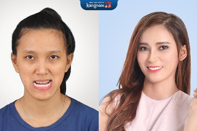 Bệnh viện thẩm mỹ Kangnam