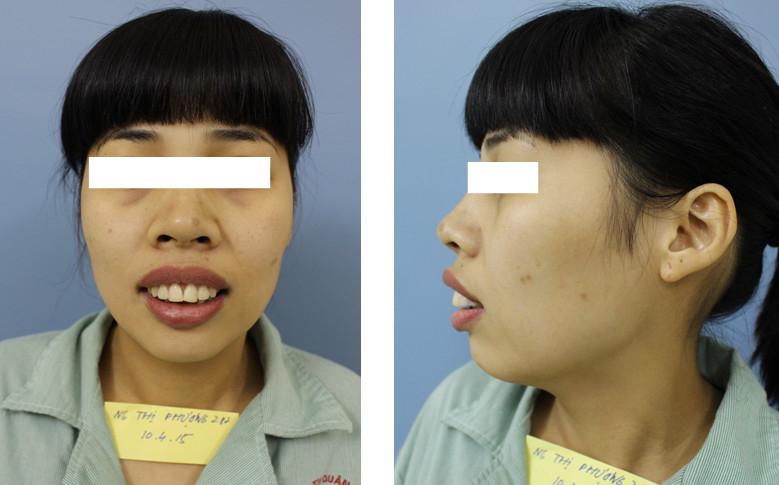 Khoa Phẫu thuật Hàm mặt và Tạo hình Bệnh viện 108