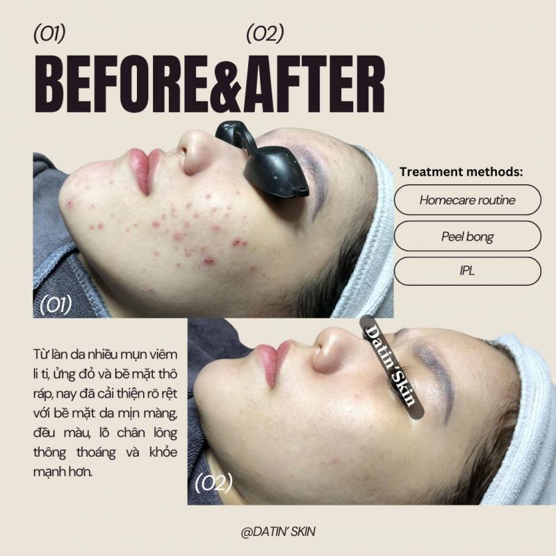 Datin' Skin