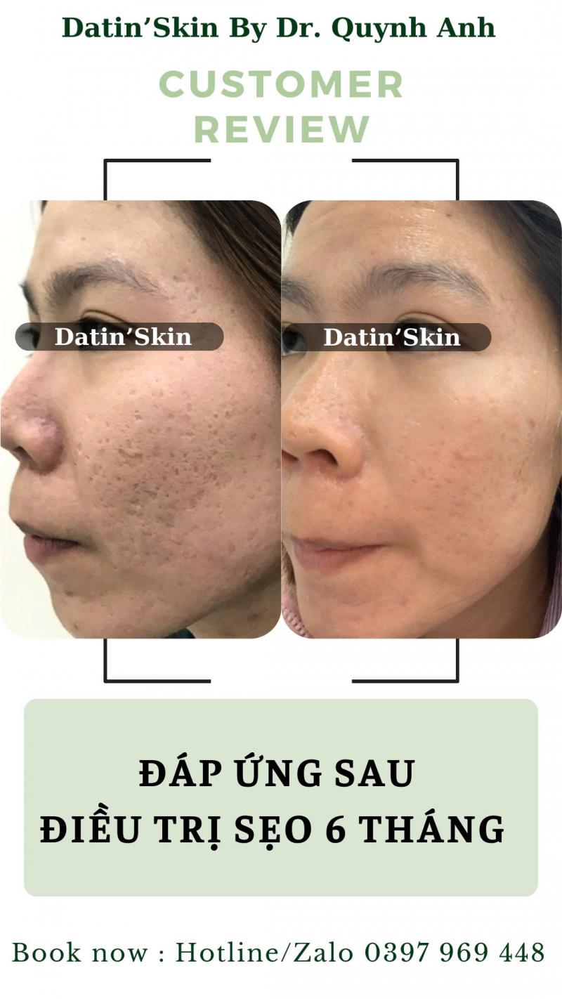 Datin' Skin