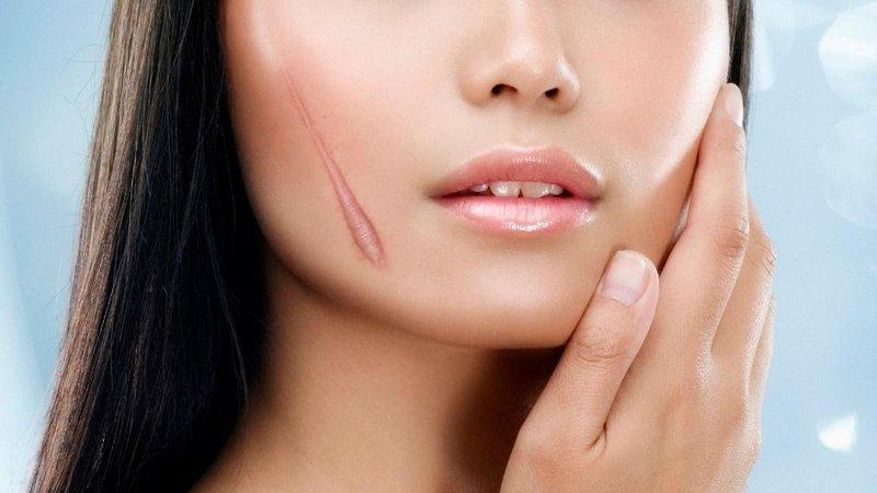 Lựu giúp chữa lành sẹo