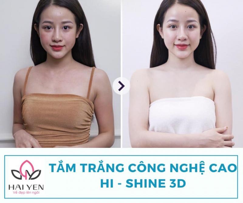 Hải Yến Spa