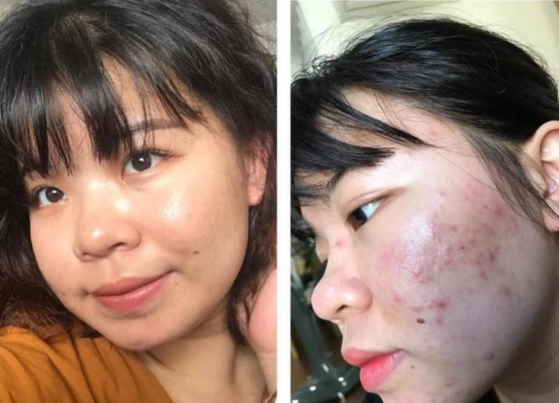 Hằng Hàn Clinic & Cosmetic