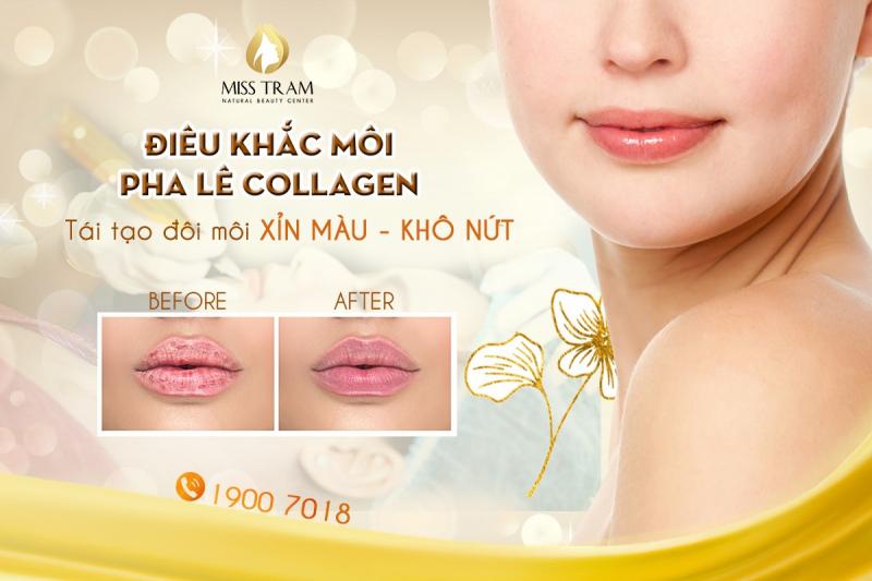 Thẩm mỹ viện Miss Tram Natural Beauty Center