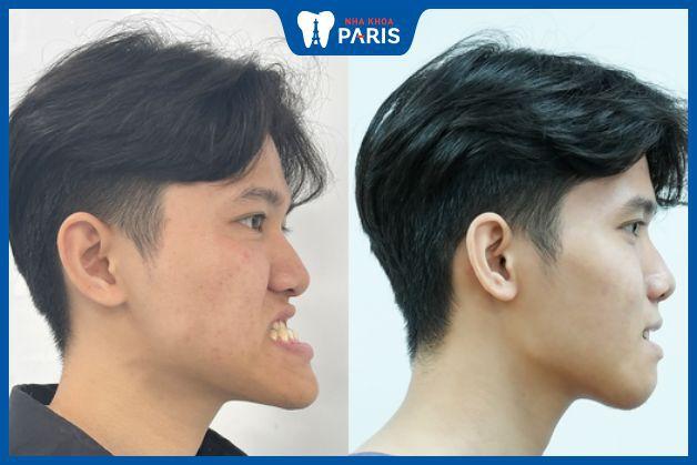 Nha Khoa Paris