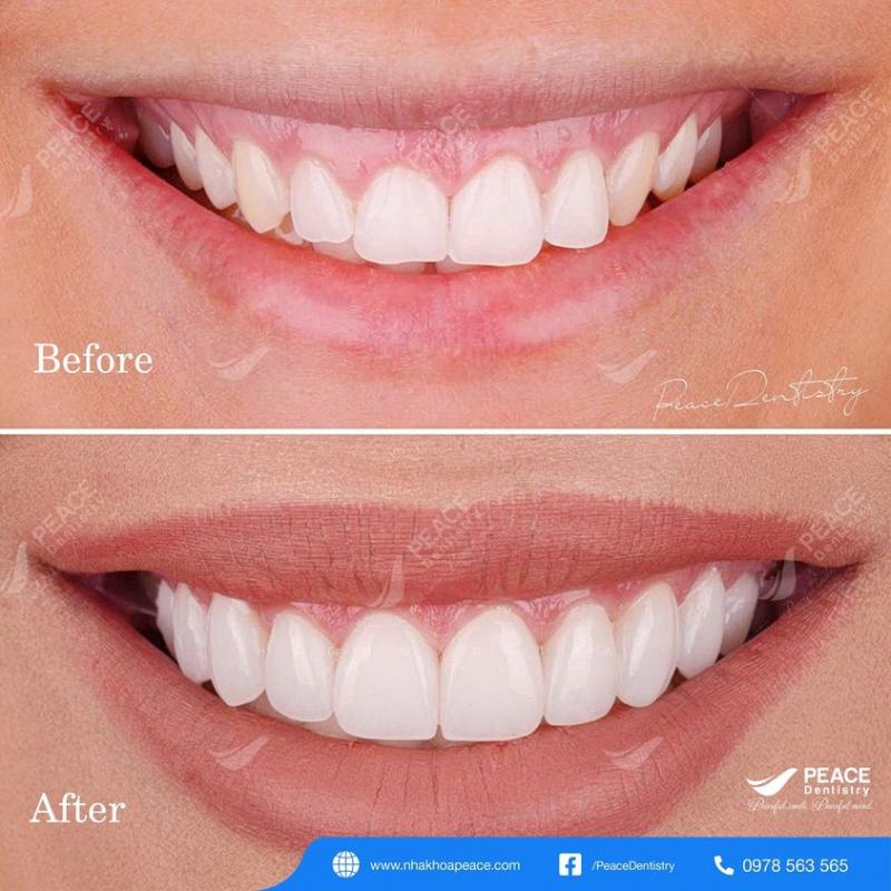 Nha khoa Peace Dentistry