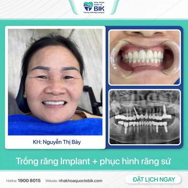 Nha khoa Quốc Tế BIK