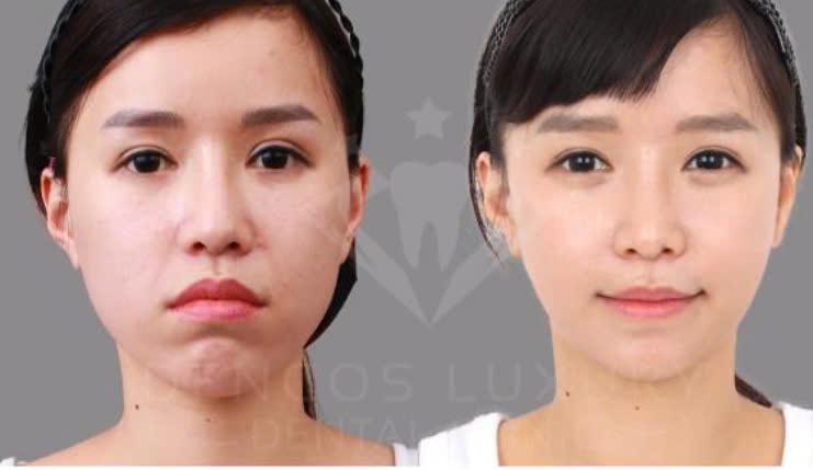 Nha Khoa Quốc Tế Dencos Luxury