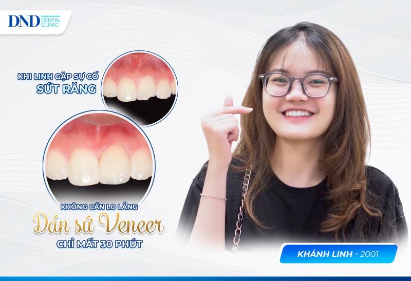Nha khoa Quốc tế DND