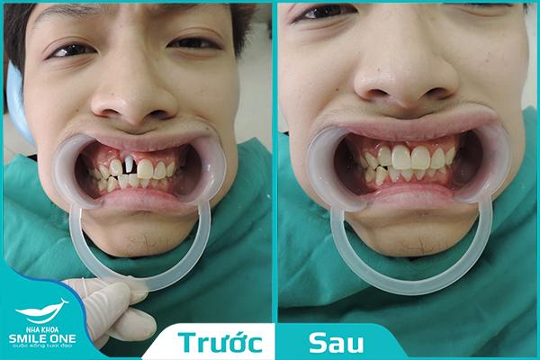 Nha Khoa Smile One