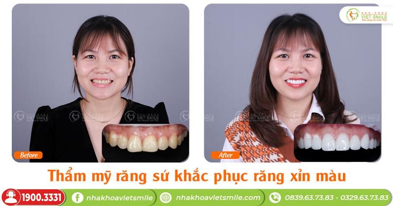 Nha khoa VIET SMILE