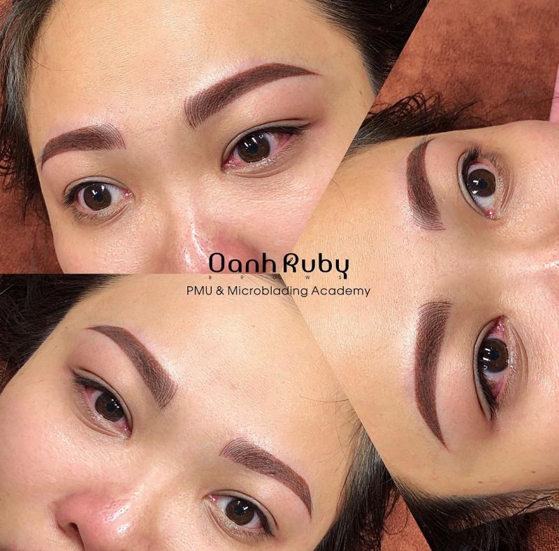Oanh Ruby - Viện Thẩm Mỹ Công Nghệ Cao