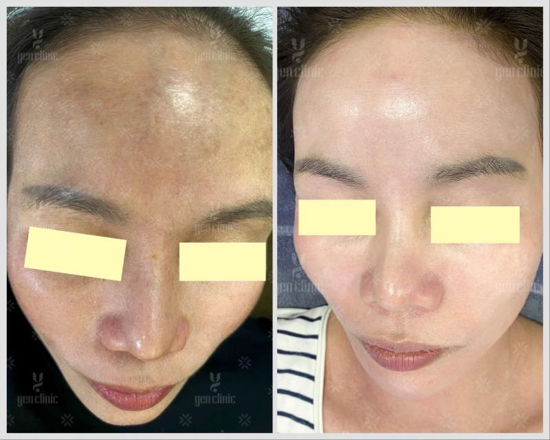 Phòng khám chuyên khoa Thẩm mỹ Yen Clini