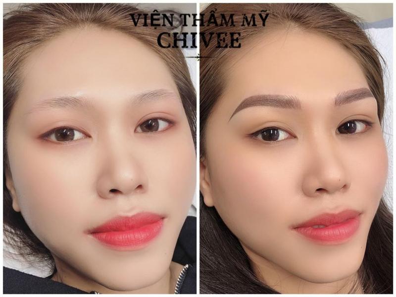 Thẩm Mỹ CHI VEE