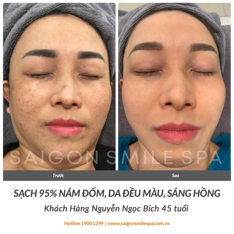 Saigon Smile Spa