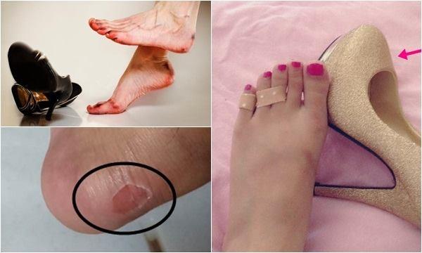 Đừng cố đi một đôi giày quá chật, bạn sẽ không biết được hậu quả sẽ tồi tệ thế nào đâu