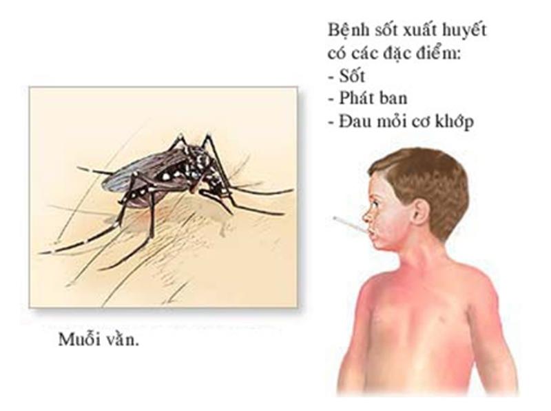 Sốt xuất huyết