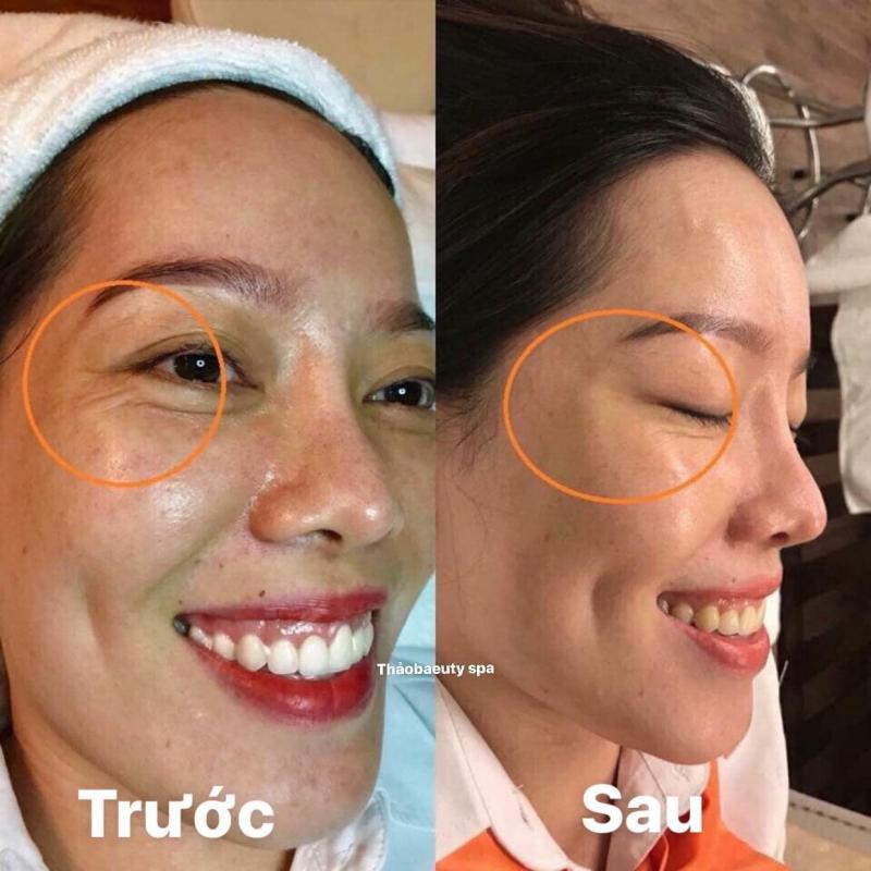 Spa Phương Thảo Beauty & Clinic