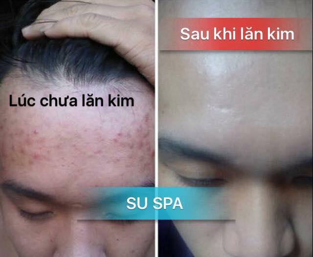 SU SPA