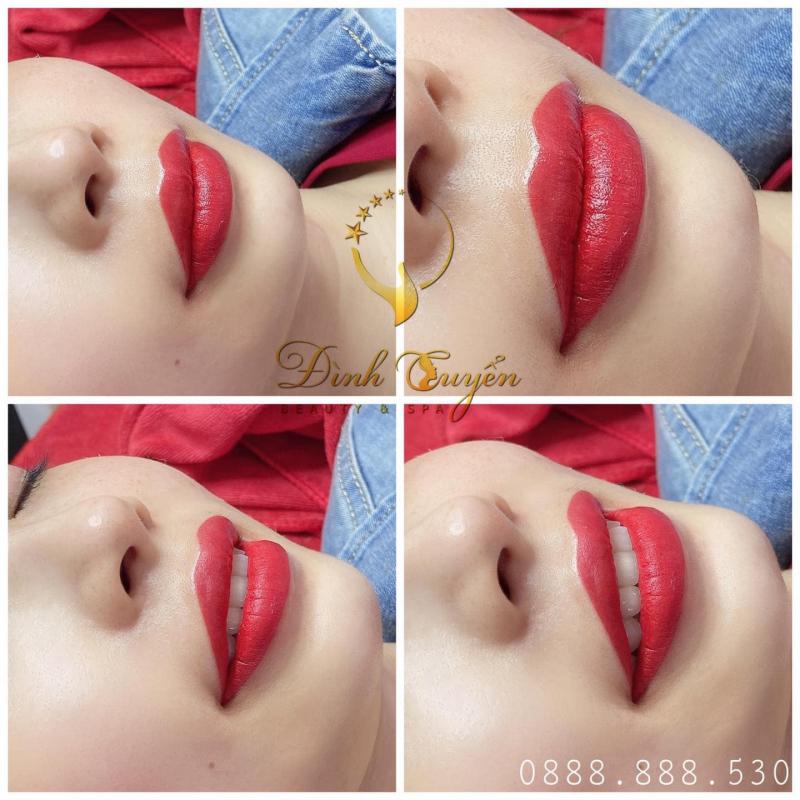 Thẩm mỹ Kang Hye