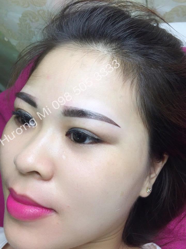 Thẩm mỹ Hiền Vy