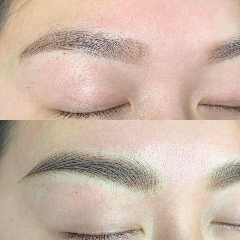 Thẩm Mỹ LENA