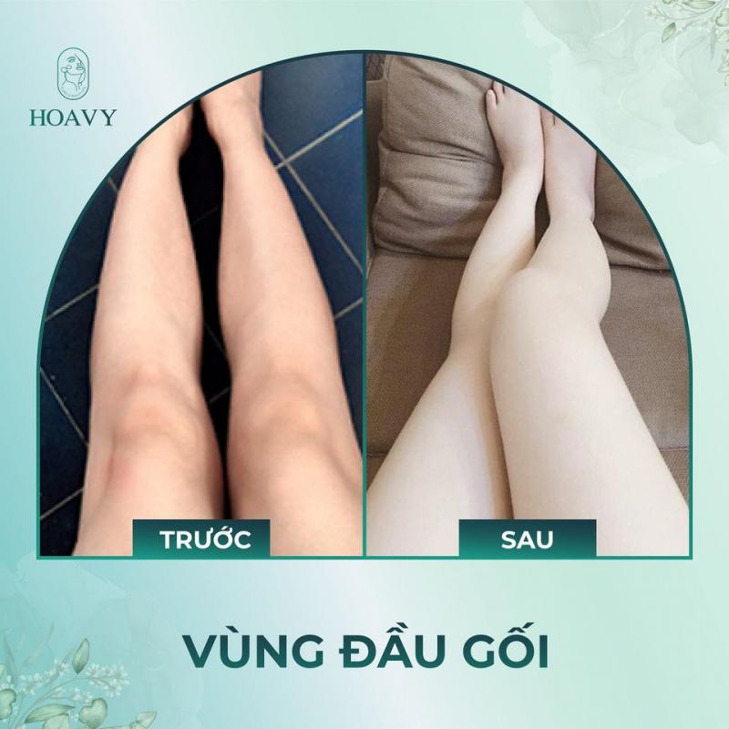 ﻿﻿Thẩm mỹ viện HoaVy