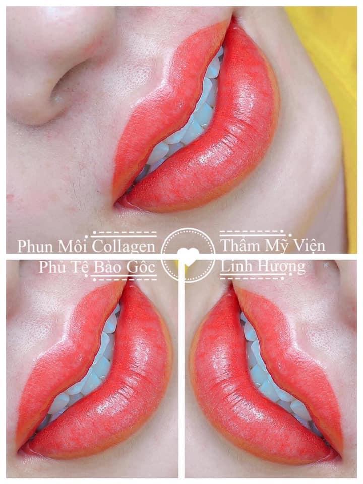 Thẩm mỹ viện Linh Hương