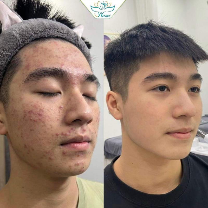 Thẩm Mỹ Viện Nami
