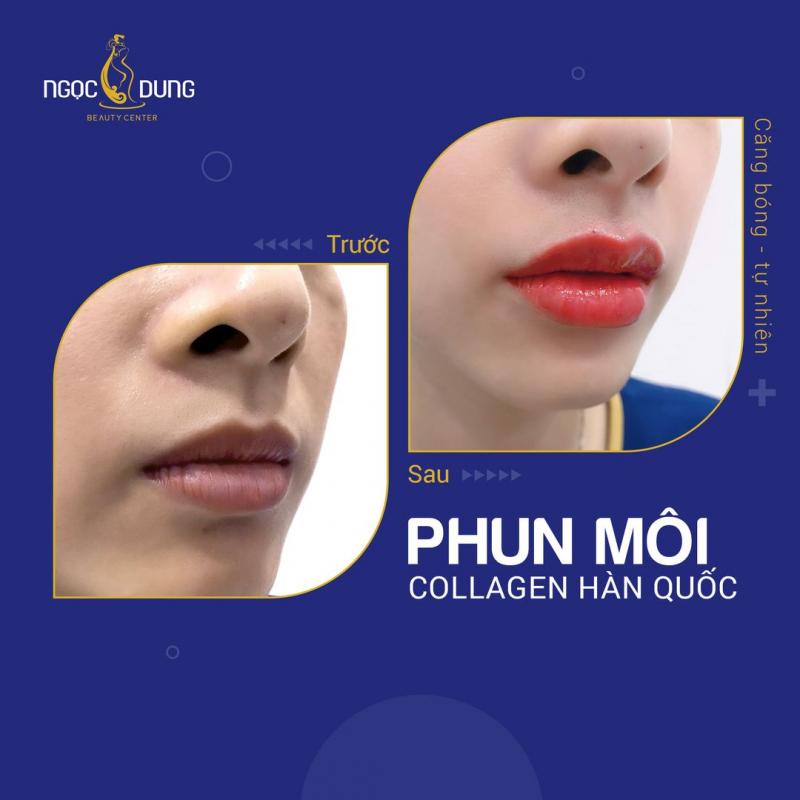 Ngọc Dung Beauty Center