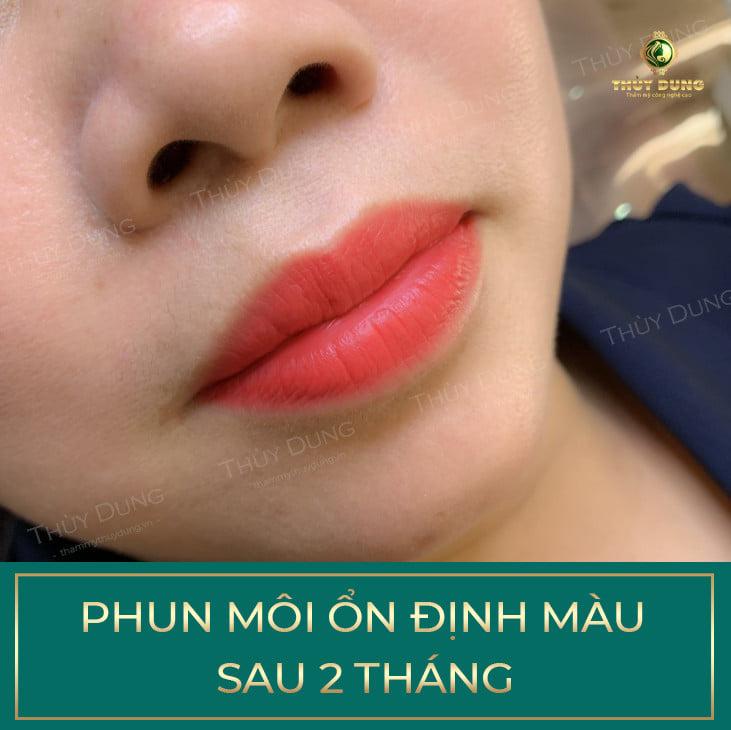 Thẩm mỹ viện Thùy Dung