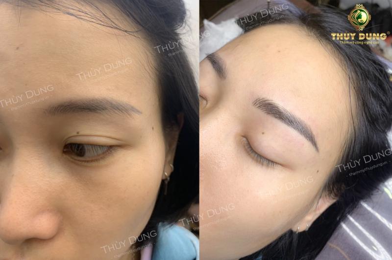 Thẩm mỹ viện Thùy Dung