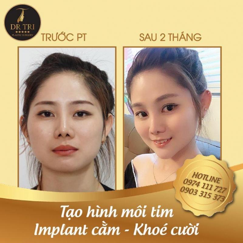 Tiến Sĩ Bác Sĩ Đỗ Thành Trí - Phẫu thuật Thẩm mỹ