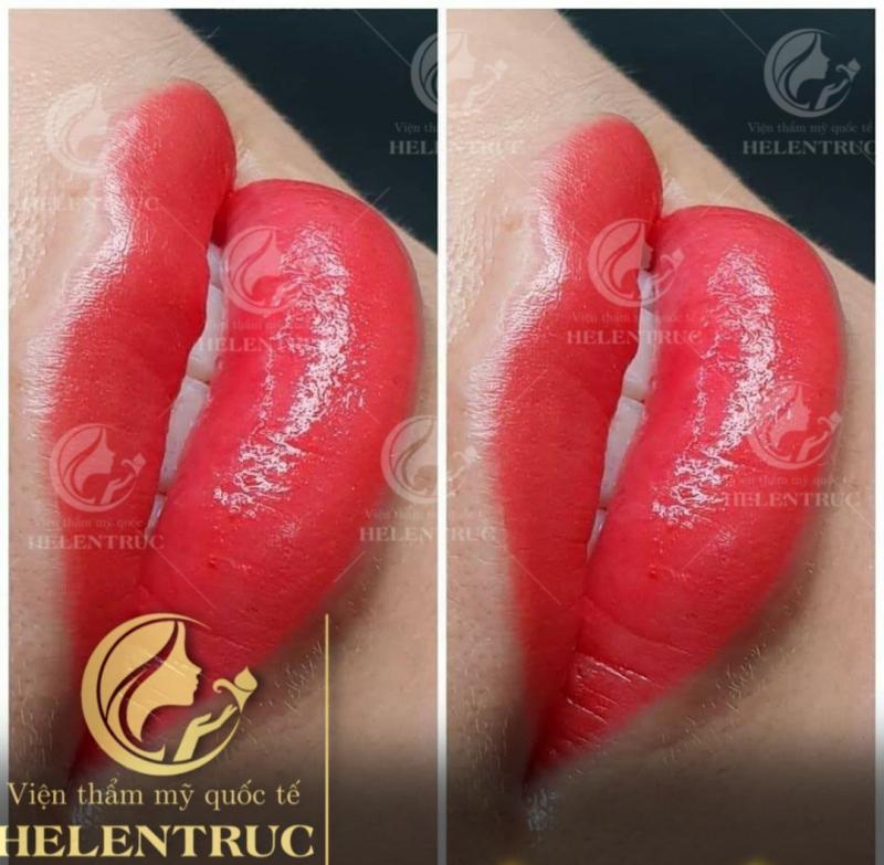Viện Thẩm mỹ Helen Truc Beauty