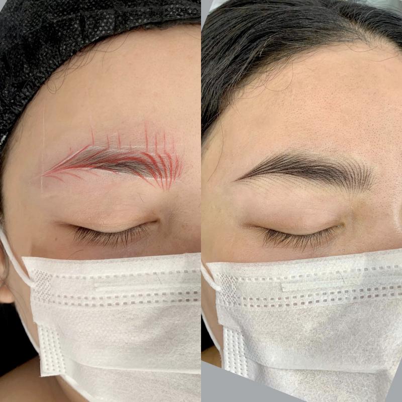 Viện Thẩm Mỹ Quốc Tế Linh Nhi'S