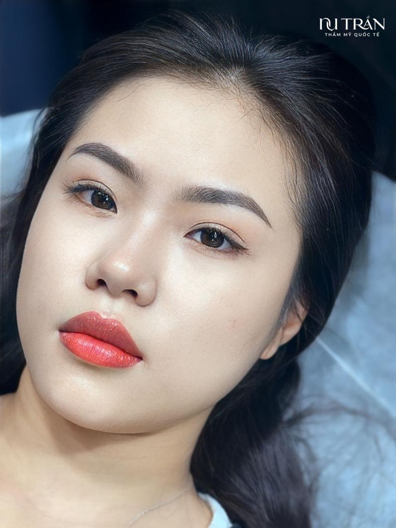 Viện Thẩm Mỹ Quốc Tế Nụ Trần